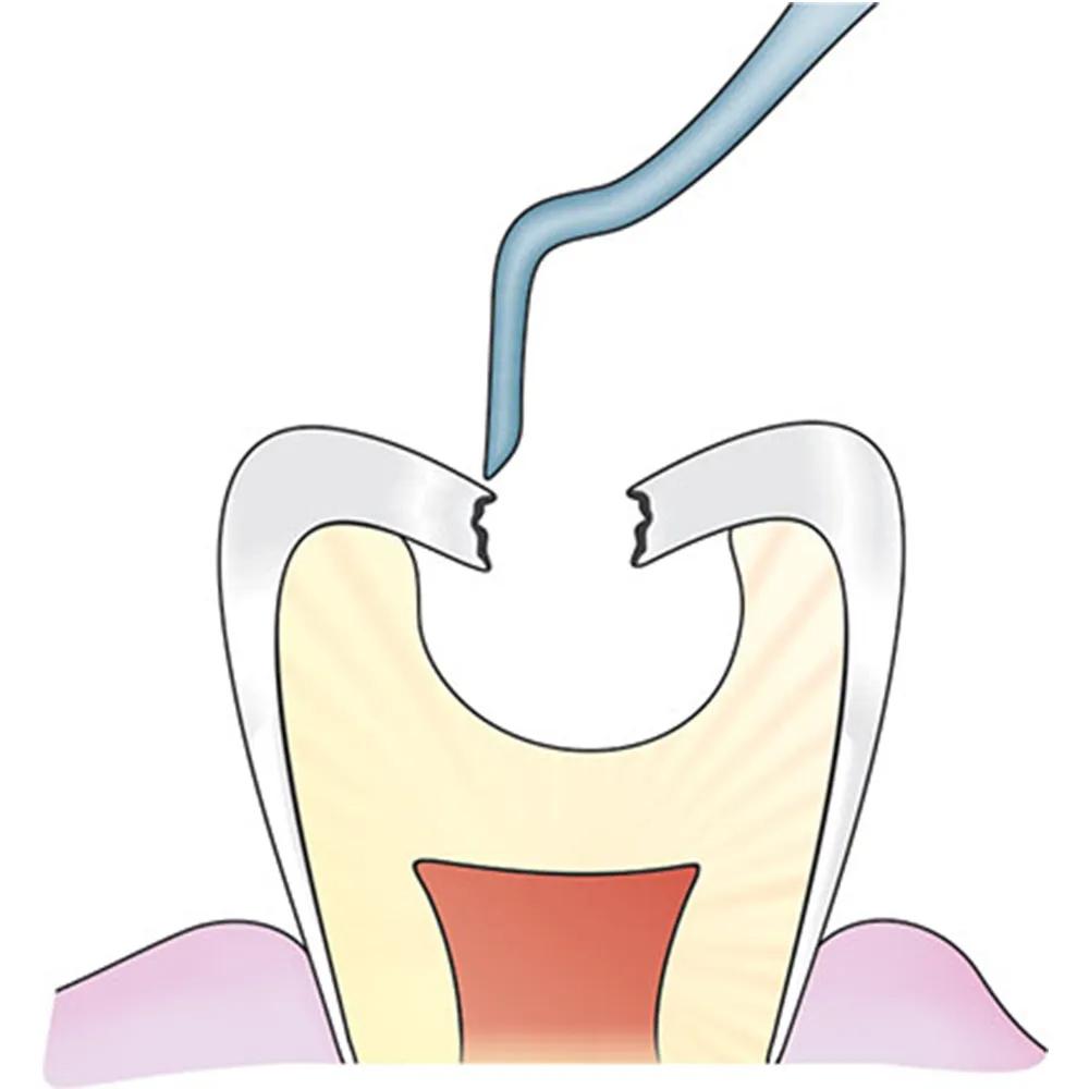 Restorative Dentistry